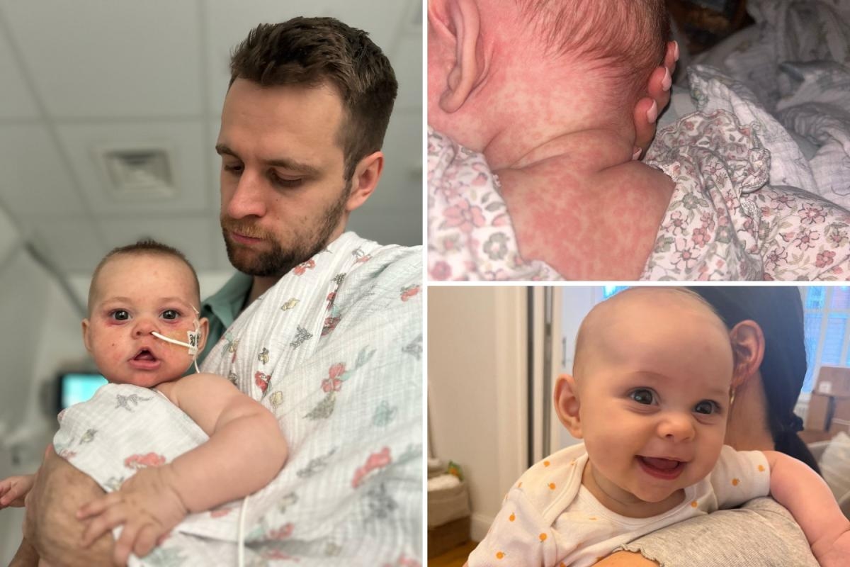 London mum urges people to get vaccinated after baby hospitalised with measles