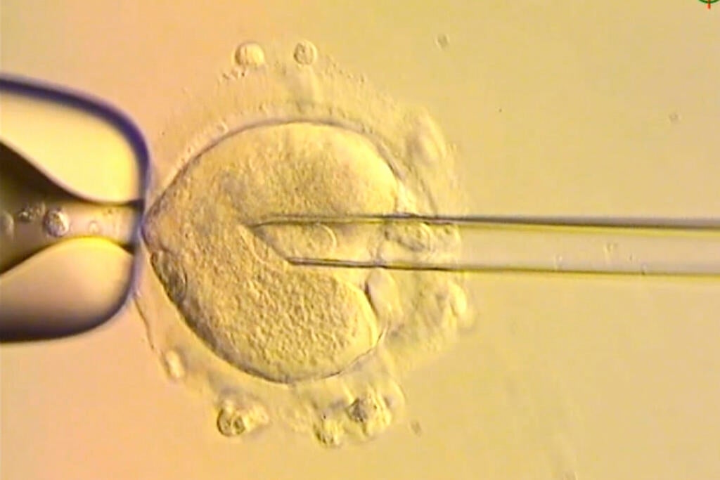 8 babies born with DNA from 3 people in world-first IVF trial