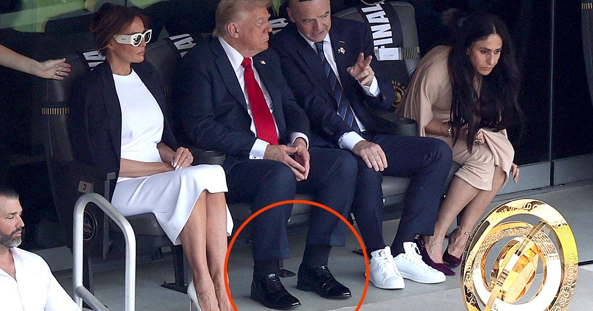Trump Undergoes Emergency Heart Tests After Swelling Detected