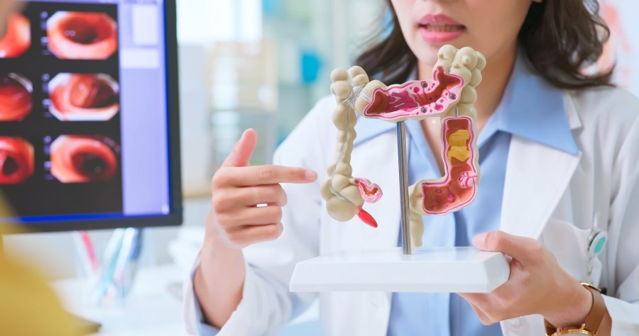 Ask A Specialist: Colonoscopy Excuses