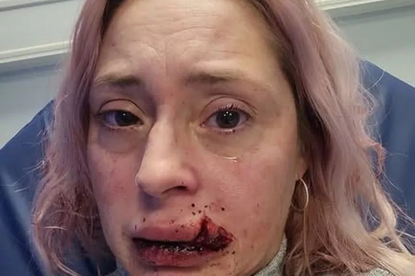 "I was walking home with my shopping - then I was left in a pool of blood"
