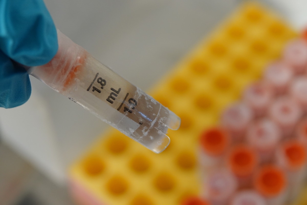 OCD May Start in the Gut, Not the Brain, Surprising New Study Finds