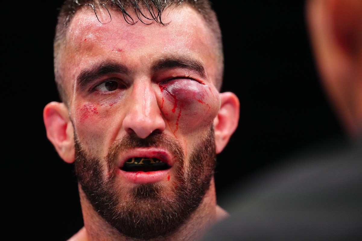 UFC Fighter's Gruesome Eye Injury Gets Surprising Update