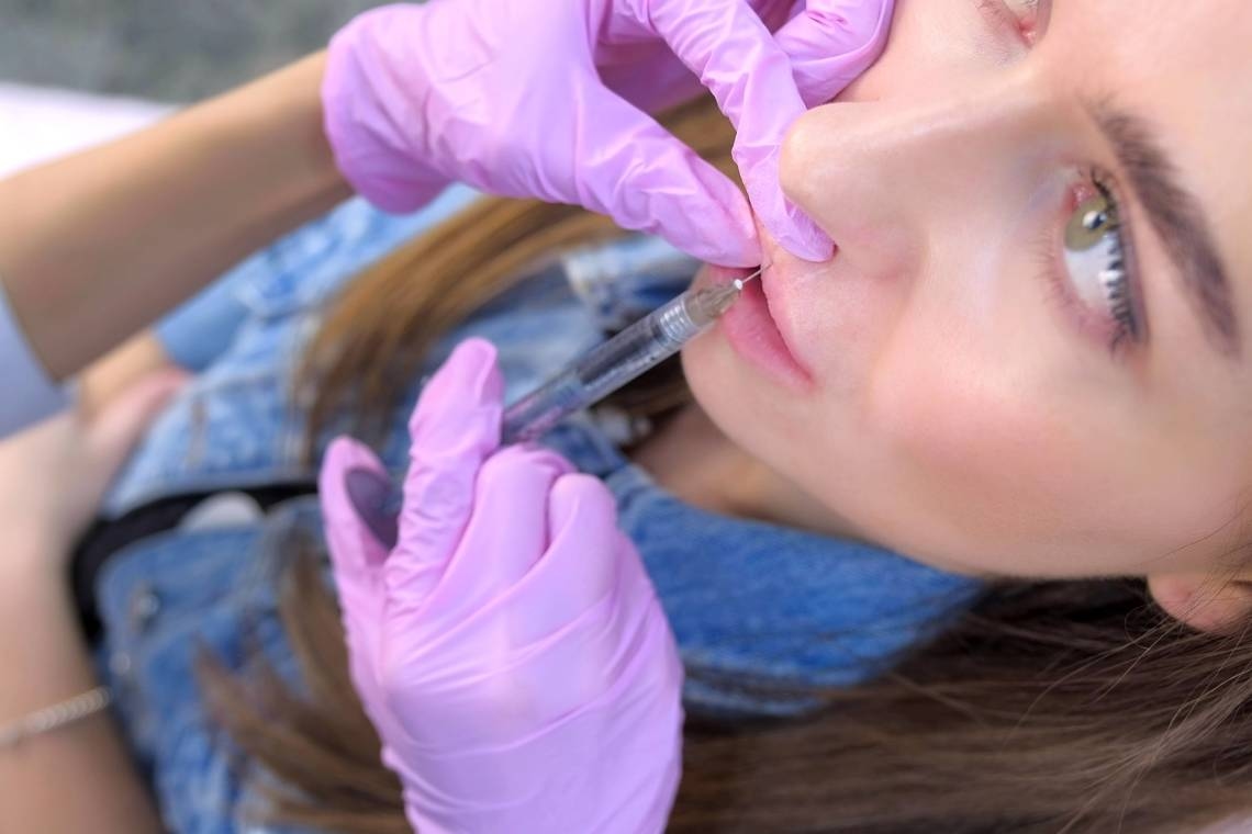 Here's what to do before and after getting lip fillers