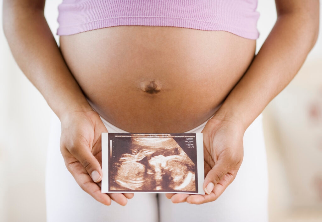 Study shows racism a major issue impacting Ohio's maternal and infant mortality rate