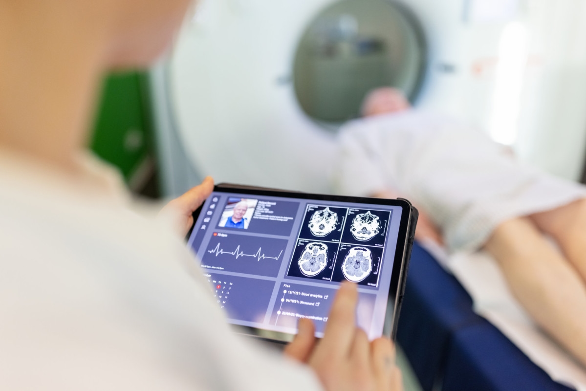 How To Know if You've Had a ‘Silent Stroke,' According to Neurologists