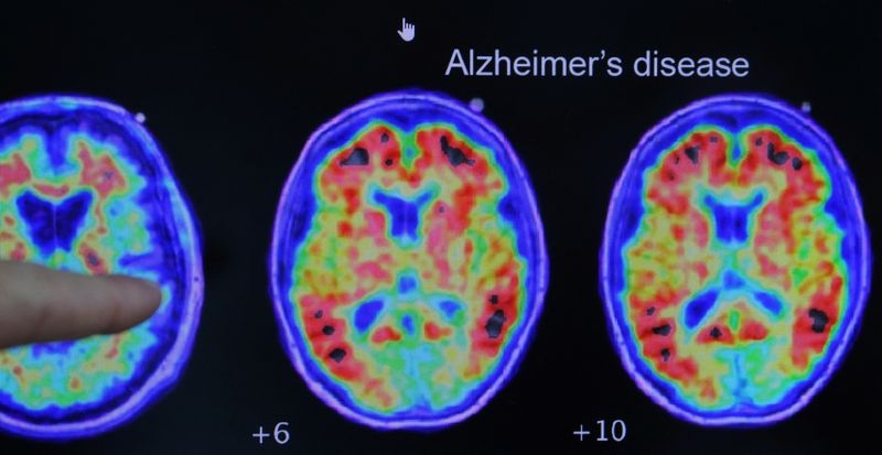 Cassava Sciences must face malicious prosecution lawsuit over Alzheimer's drug