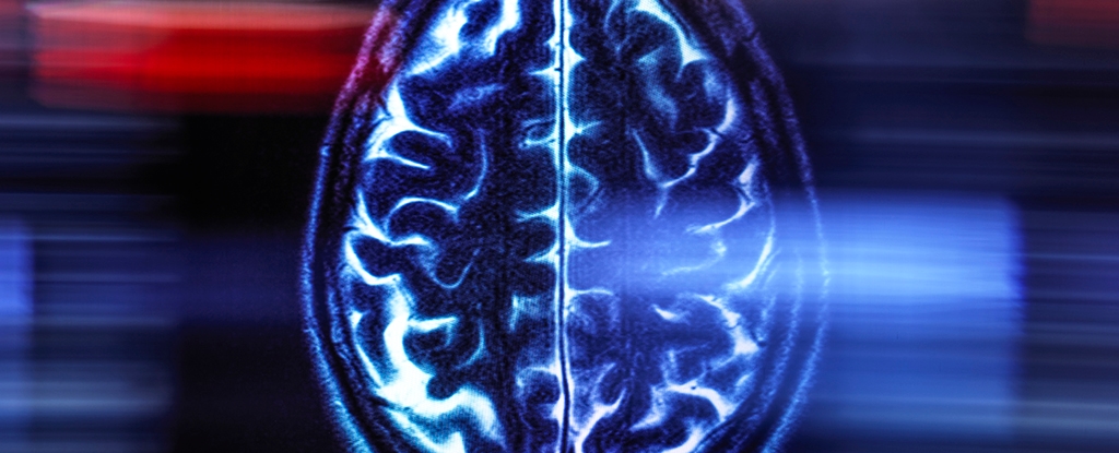 A Single Brain Scan Halfway Through Your Life Can Reveal How Fast You're Aging