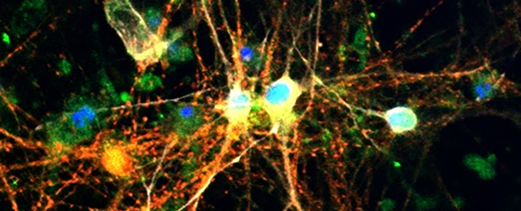 Surprise Discovery About Sugar in The Brain Could Help Fight Alzheimer's