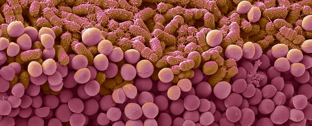 Yo-Yo Dieting May Trigger Long-Lasting Changes in Gut Bacteria