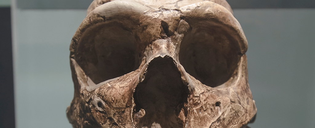 Brain Abnormality in Modern Humans Linked to Ancient Neanderthal DNA