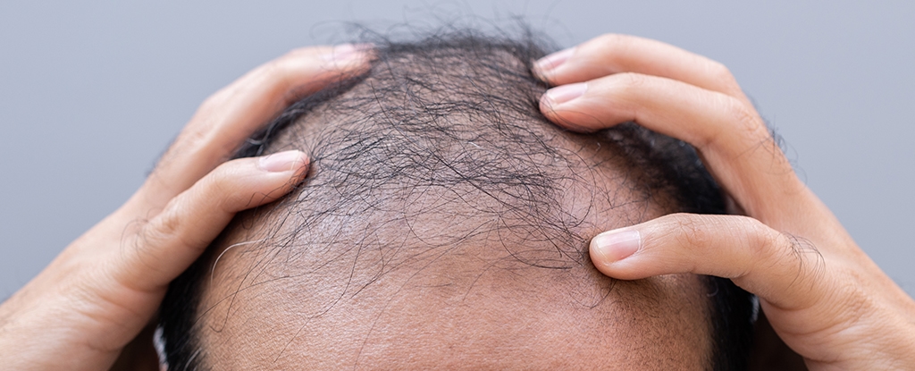 Protein That Calms Waking Hair Follicles Could Lead to Alopecia Treatment
