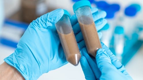 Could faecal transplants cause long-term health problems?