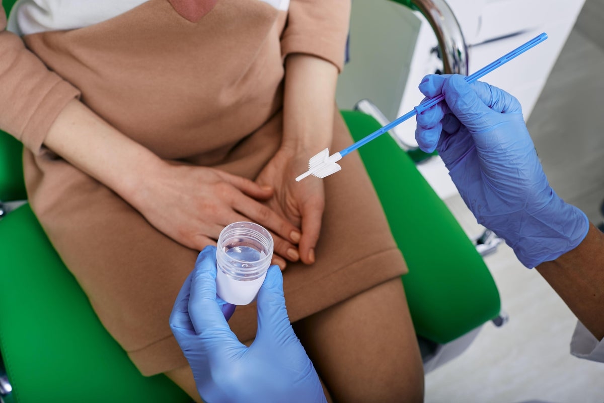 New study says self-test could prevent up to 1,000 cervical cancer cases a year