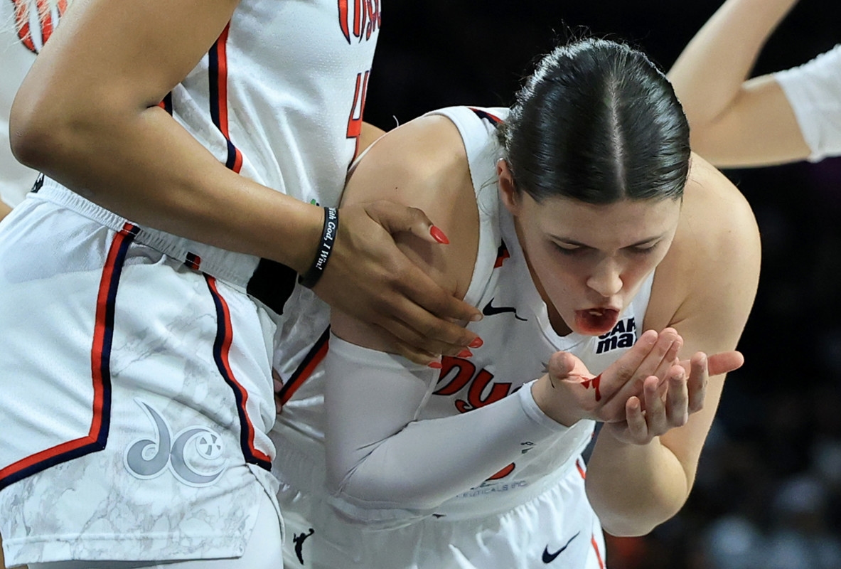 WNBA Player Shows Off Gnarly Injury After Getting Elbowed In The Face
