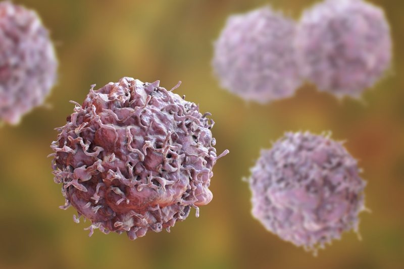Genetic testing IDs some at higher risk for colorectal cancer
