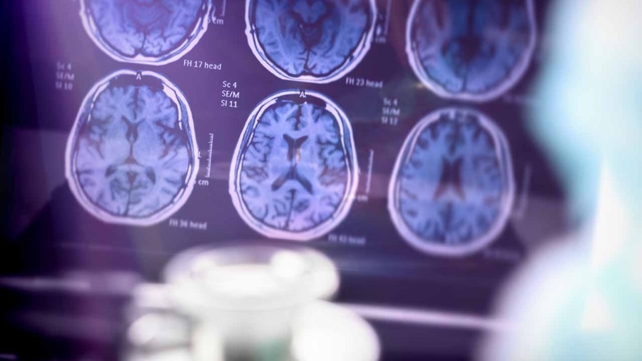 Onslow County Public Library in Swansboro to host Alzheimer's event
