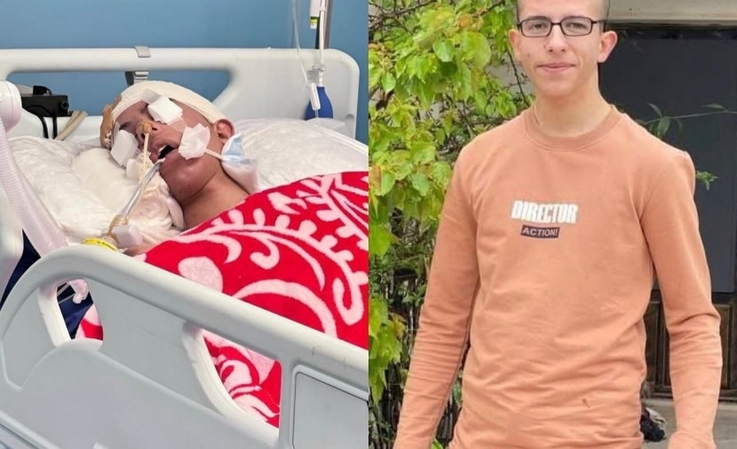 استشهاد شاب فلسطيني متأثراً بإصابته برصاص الاحتلال