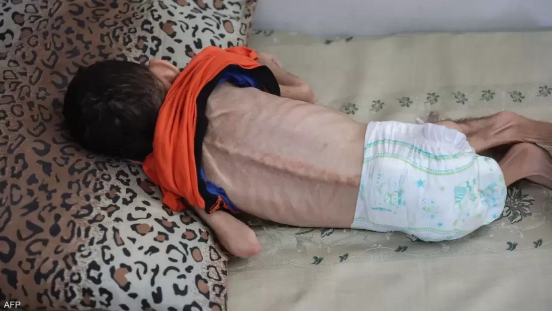 تحذيرات من موت جماعي للرضع في غزة بسبب منع الاحتلال إدخال حليب الأطفال