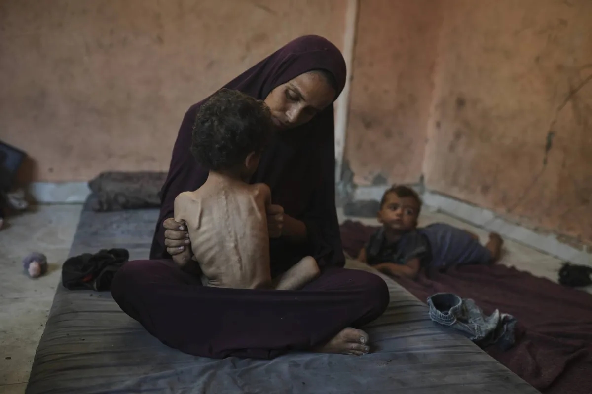 غزة: وفاة رضيع نتيجة سوء التغذية ونقص الحليب