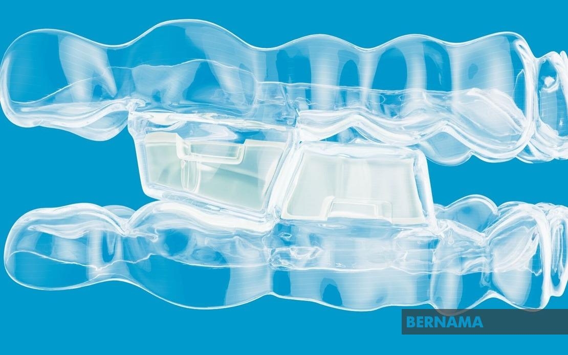 Align Technology Announces Invisalign® System With Mandibular Advancement Featuring Occlusal Blocks For Class Ii Skeletal And Dental Correction