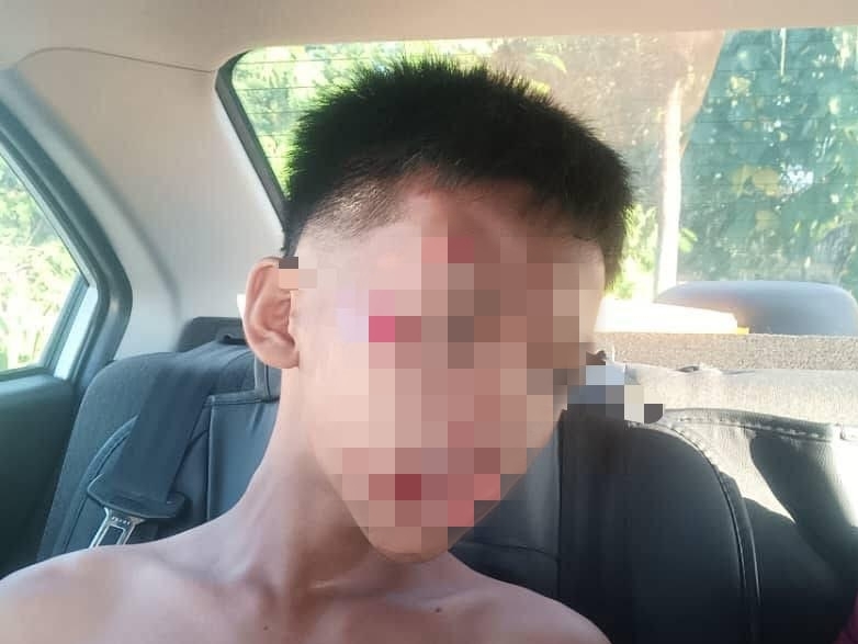 Teen hurt after chased by strays