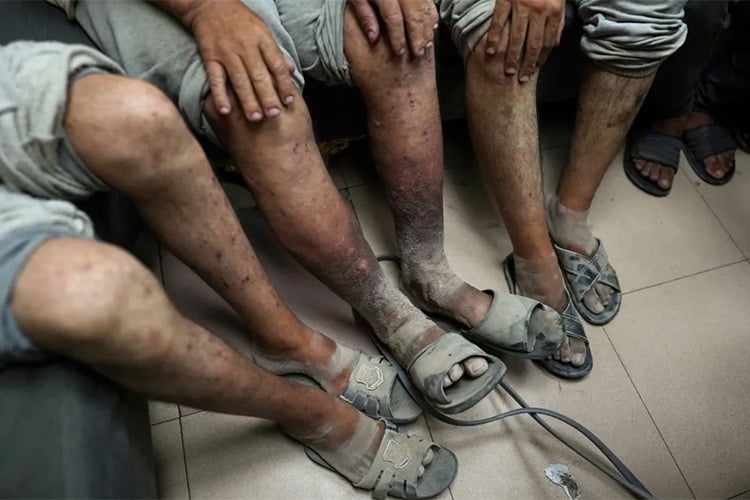 هيئة حقوقية تدعو لتحقيق دولي بجرائم التعذيب ضد الفلسطينيين