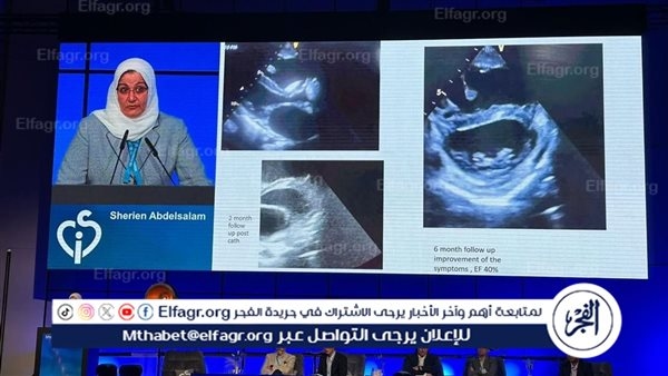 مصر تلمع في سماء الطب العالمي.. «شيرين عبد السلام» تمثل مستشفى الناس في أكبر مؤتمر دولي لعيوب القلب الهيكلية