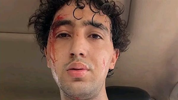 العناية الإلهية تنقذ رفاعي.. فتوح يثير الجدل بصورة العين السخنة.. والمثلوثي فى الصفاقسي
