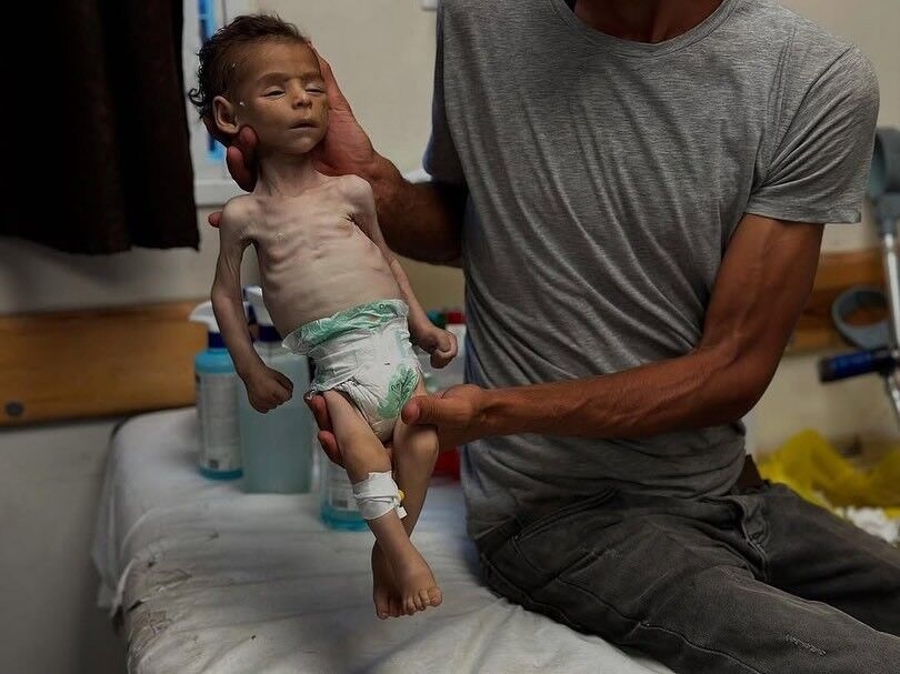 غزة تموت جوعاً.. 'الأونروا' تدعو لرفع الحصار لإنهاء المجاعة