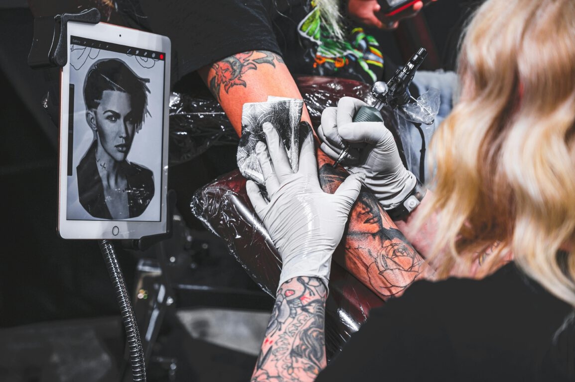 Got a Geeky Tattoo You Hate? Here's What The Laser Removal Process Looks Like