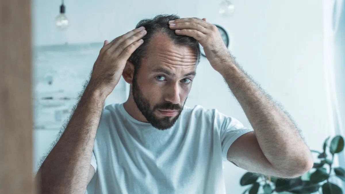 New Stem Cell Therapy Shows 'Promising' Results For Treating Hair Loss In Preclinical Trials
