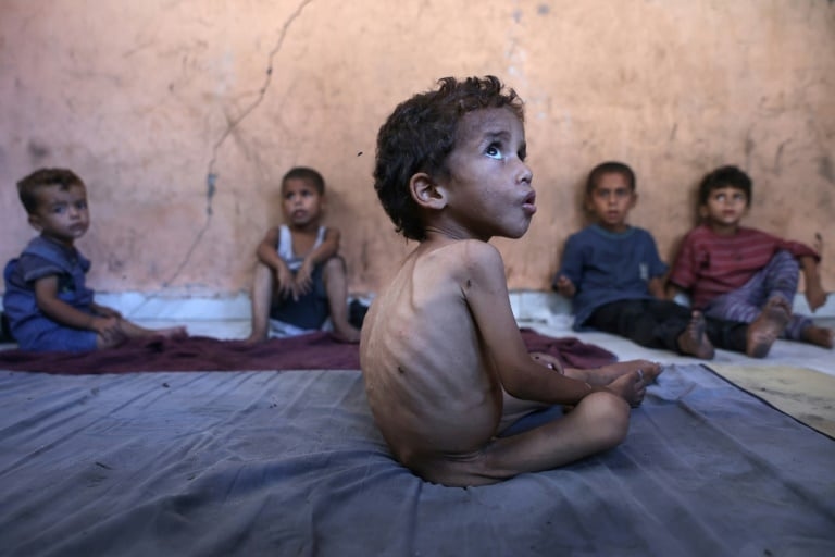 WHO chief says large proportion of Palestinians ‘starving'