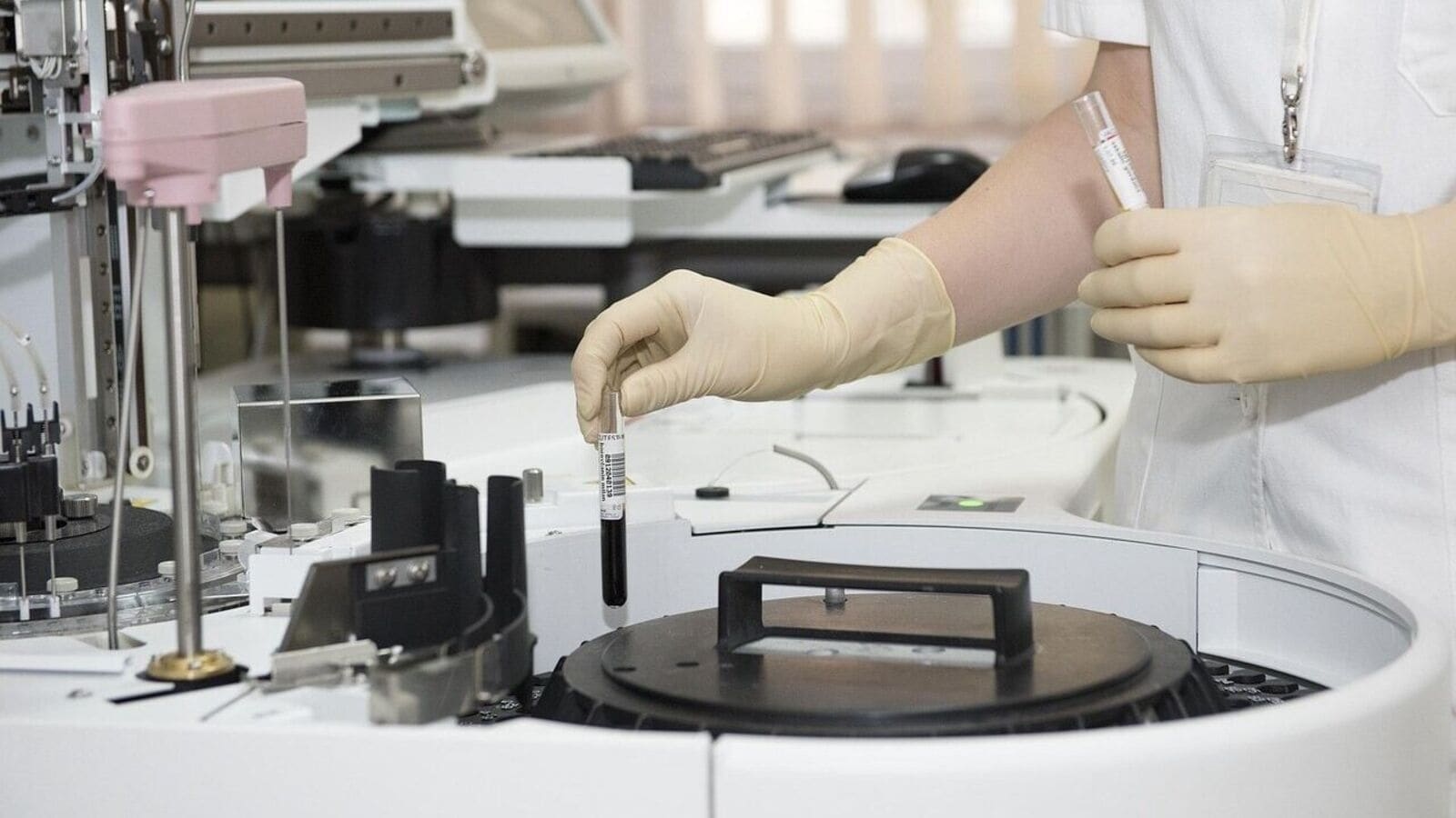 Metropolis, Dr Lal PathLabs shares dip up to 3% as Amazon enters diagnostic market
