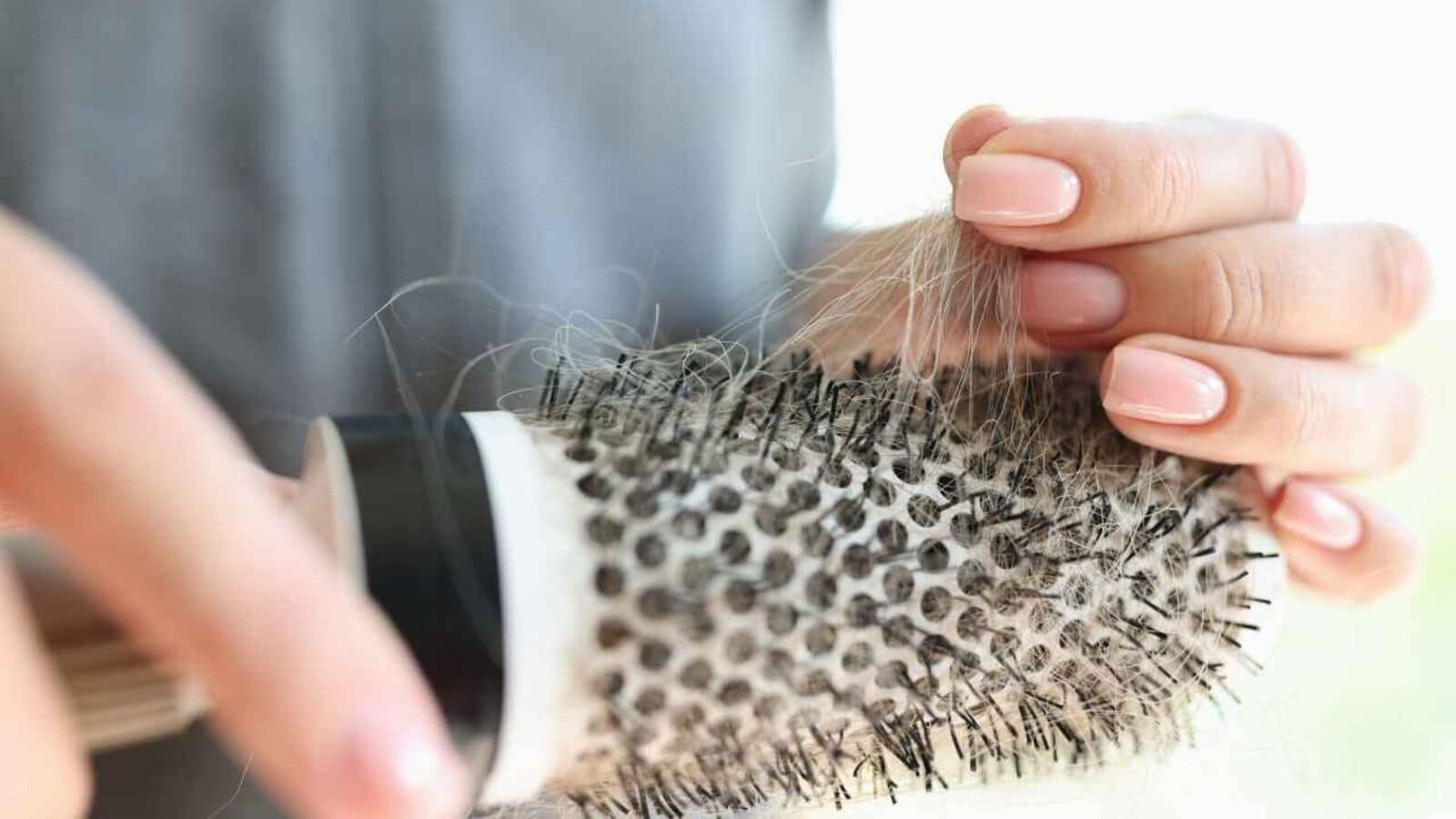 Hair loss isn't just a man's problem. Four ways to treat female baldness.
