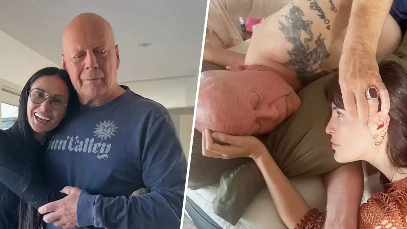 What is frontotemporal dementia that Bruce Willis is suffering from? Symptoms, treatment and more