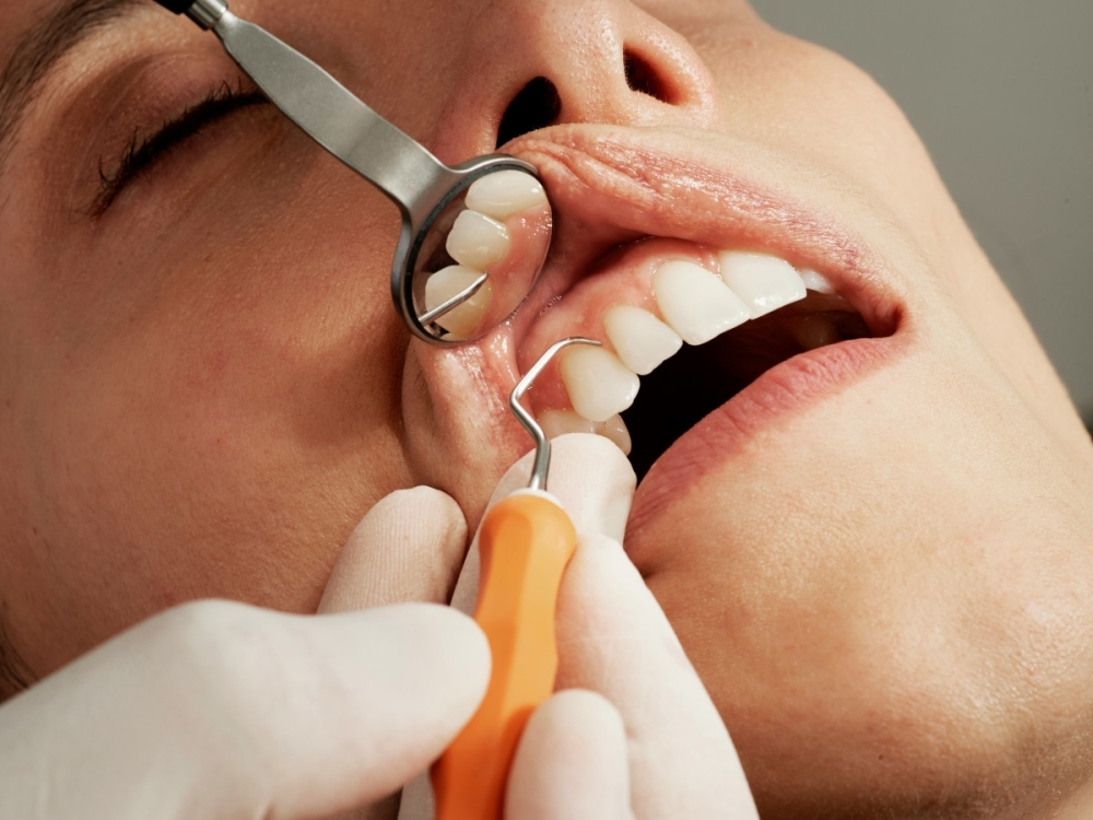 How dentists can help in Malaysia's HIV response — Tan Chuey Chuan, Goh Yet Ching
