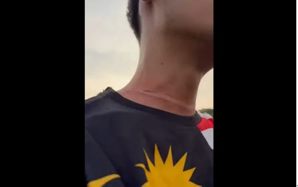 Kite string slices motorcyclist's neck in freak accident on MRR2 near Kepong park