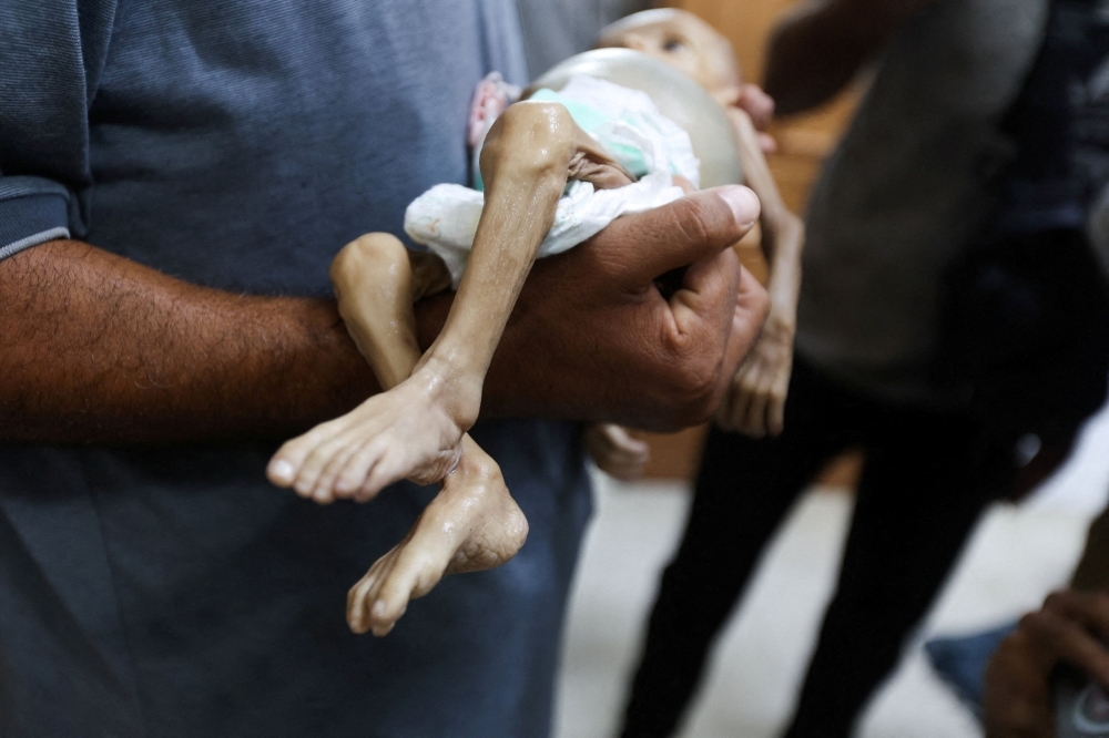 Hunger is killing Gaza's children, and it's man-made, says WHO
