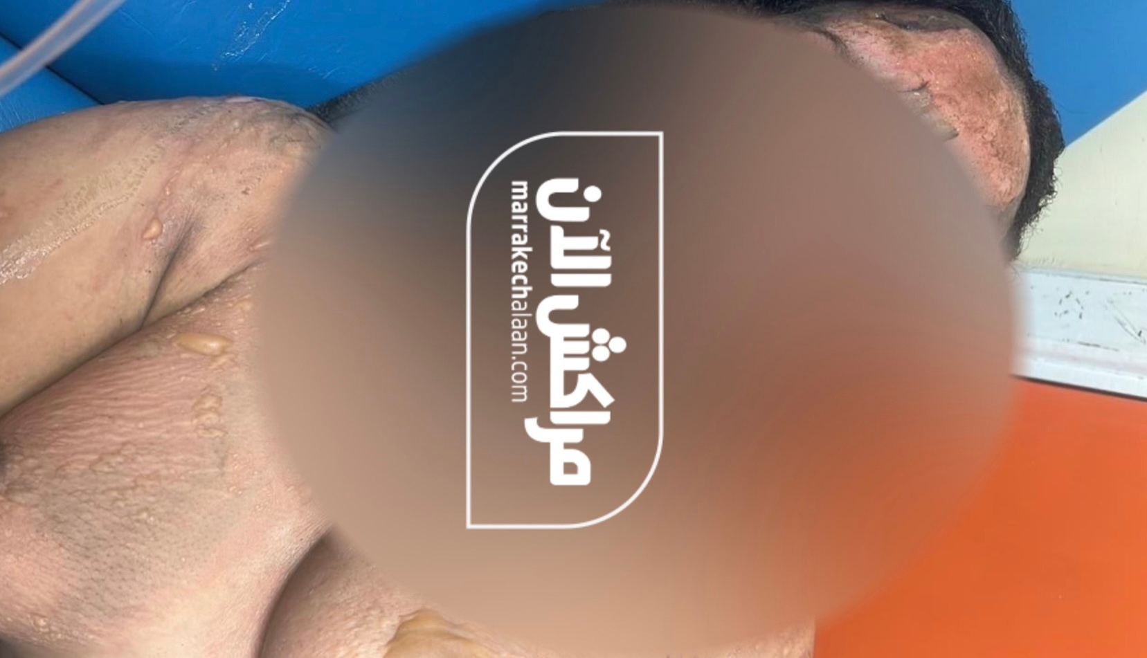 'مراكش الآن' تكشف تفاصيل العثور على فتاة مختفية بحالة صحية ونفسية حرجة