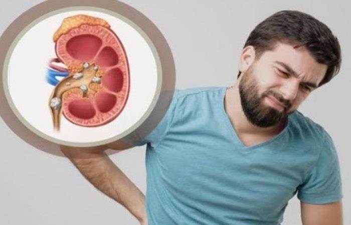 أخبار مصر : هذه المشروبات نتناولها يوميا وتسبب الفشل الكلوي.. تفاصيل