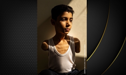 Amputee Palestinian boy image wins World Press Photo award