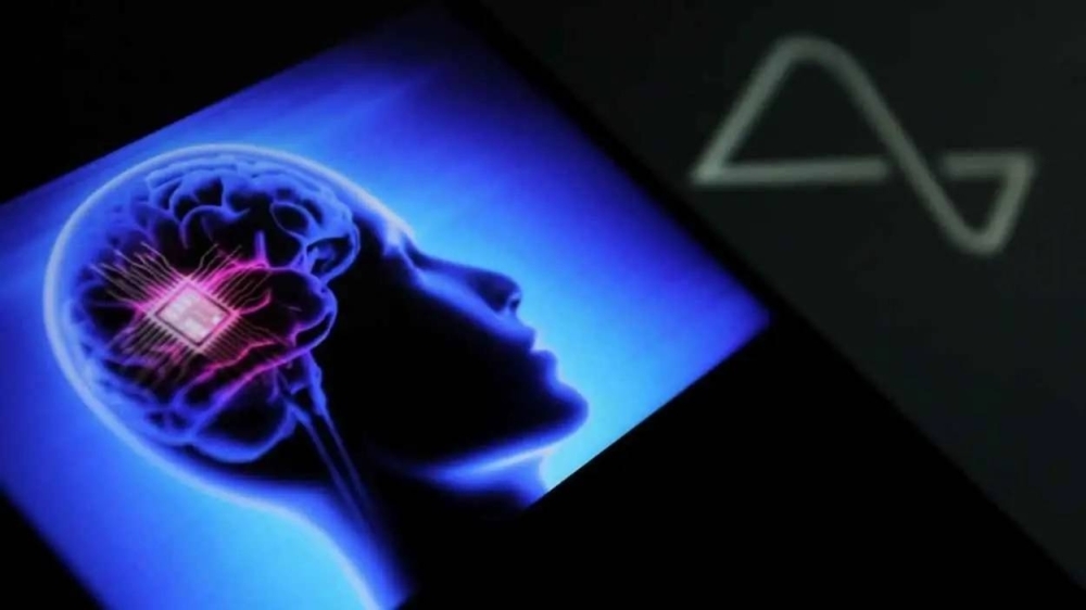 بدقة 90%.. شريحة دماغية تحول الأفكار إلى نصوص!