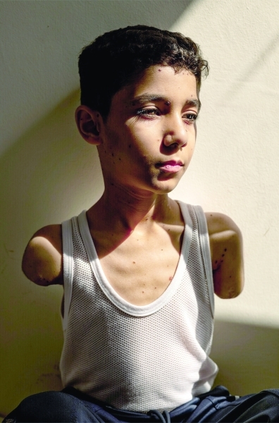 Amputee Palestinian boy photo wins award