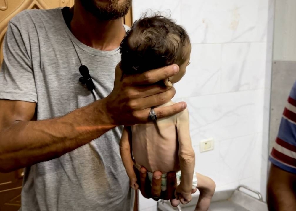 WHO warns of ‘surge' in malnutrition deaths in Gaza