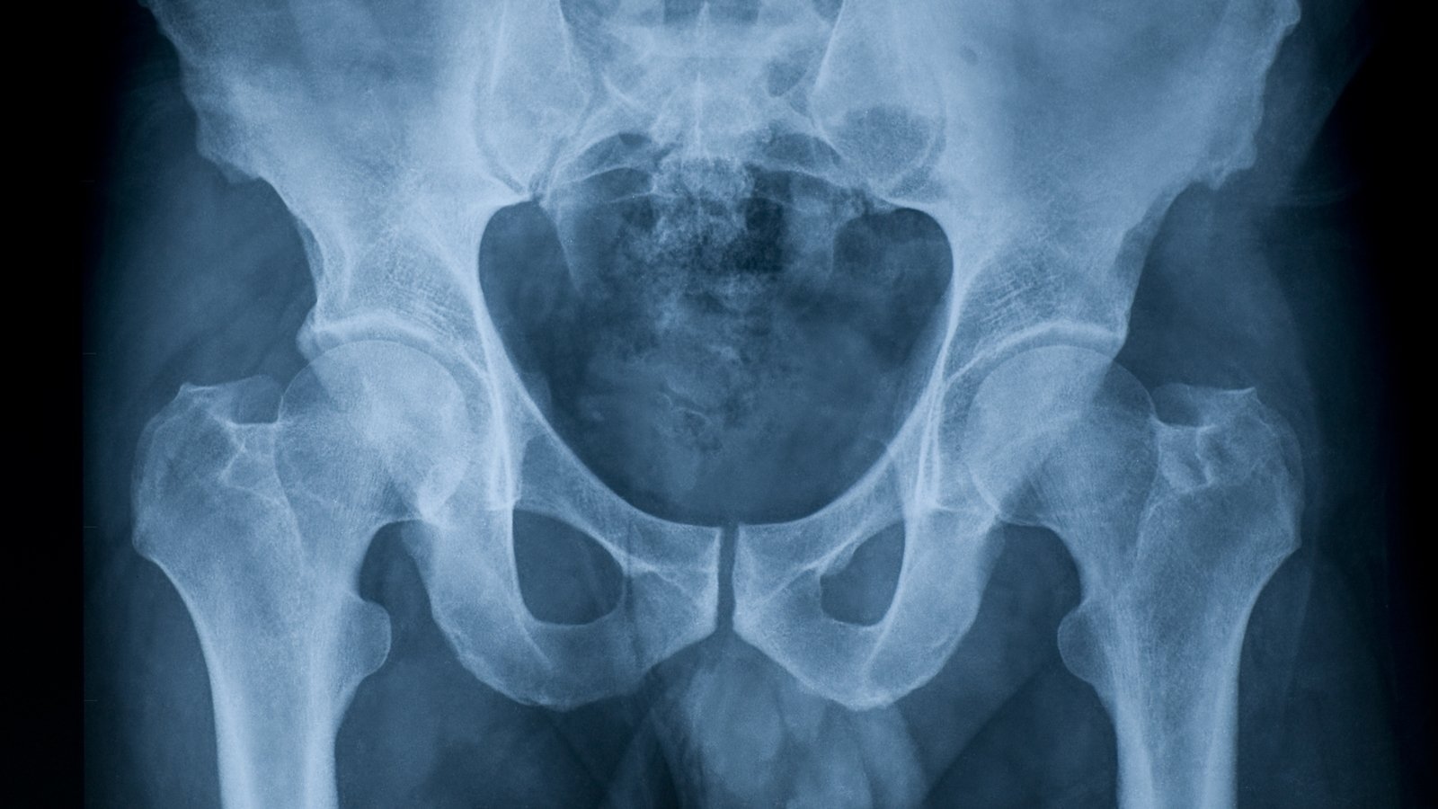 Promise to publish audit on children's hip surgeries