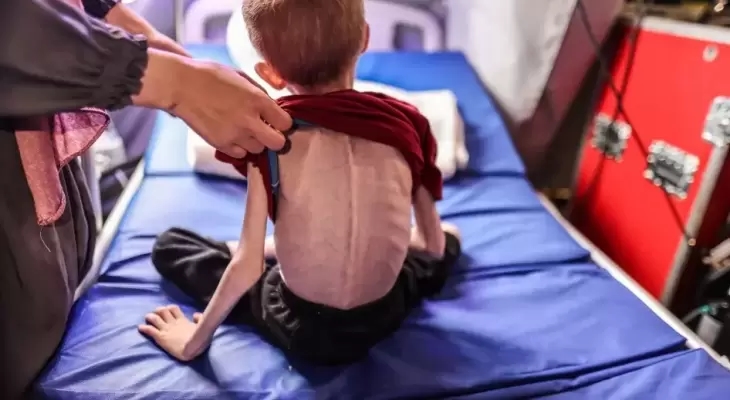 Gov't media: Malnutrition kills 66 children so far
