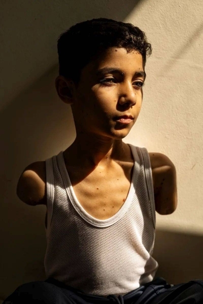 Portrait of injured Gazan boy named press photo of the year