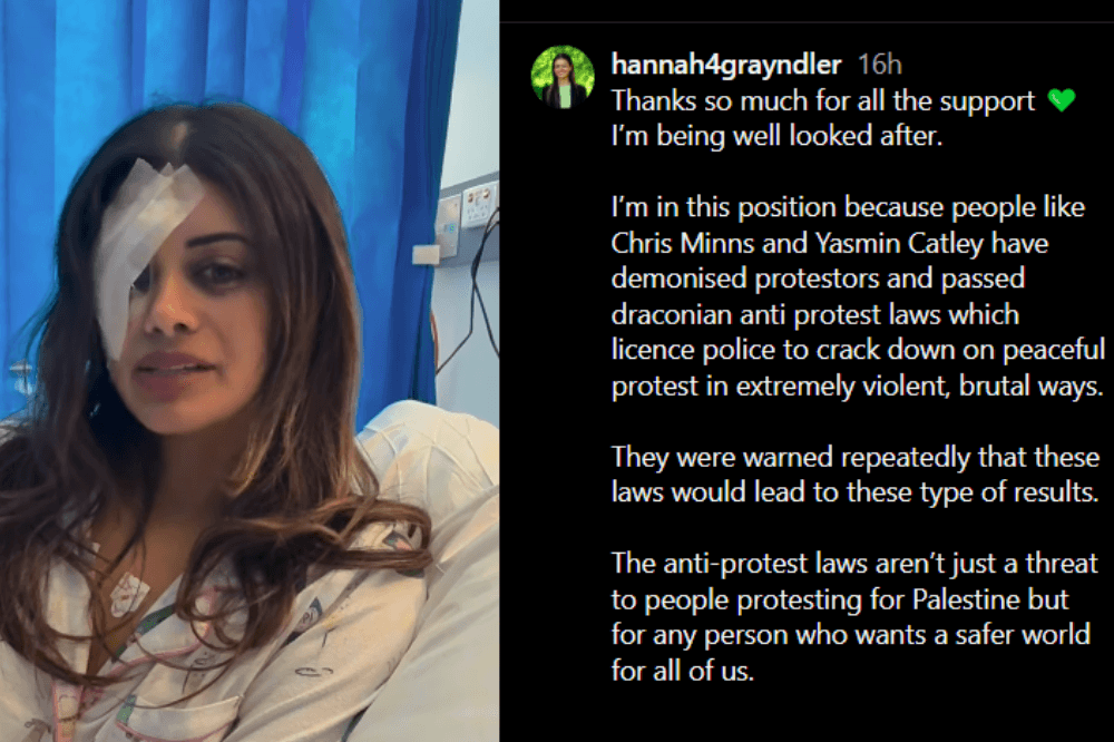 Ex-AG's daughter may lose vision after arrest at Sydney pro-Palestine protest