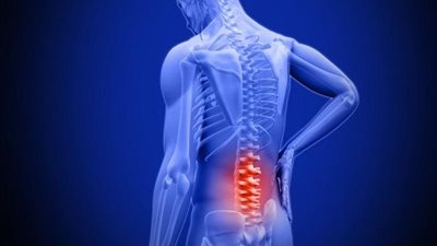 علاج بدون دواء.. دراسة تكشف دور العقل في تخفيف آلام الظهر المؤلم